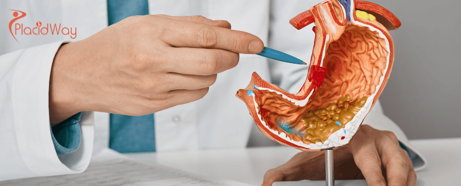 Magenbypass in der Türkei