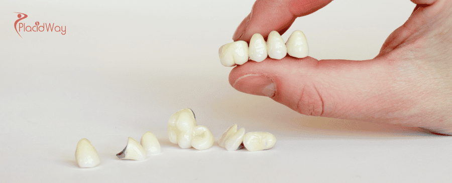 Dental Crowns in Mexico