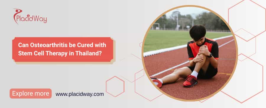 Can Osteoarthritis be Cured with Stem Cell Therapy in Thailand