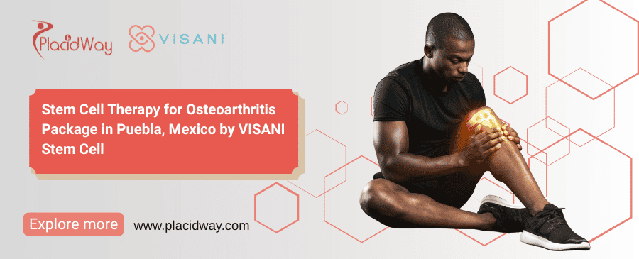 Stem Cell Treatment Mexico Cost for Osteoarthritis by VISANI