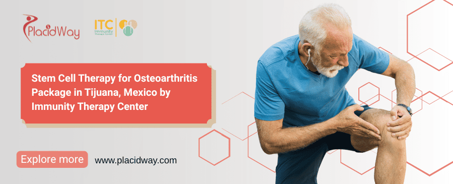 Osteoarthritis Stem Cell Treatment Tijuana Package by ITC