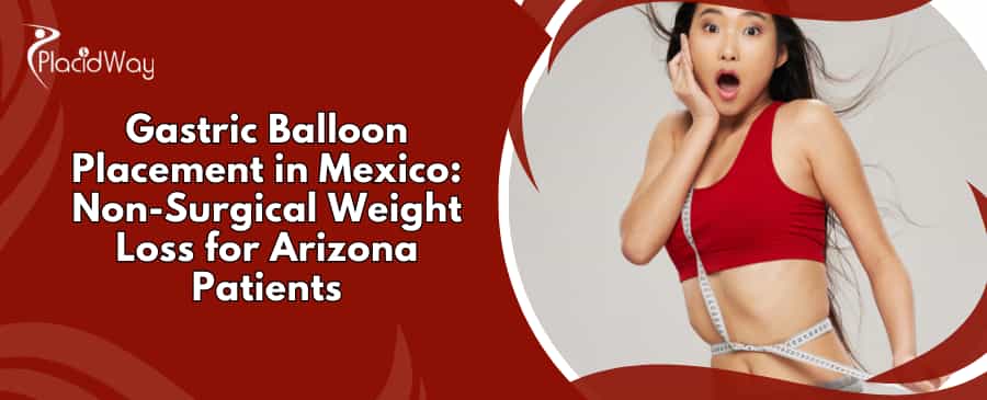 Gastric Balloon in Mexico