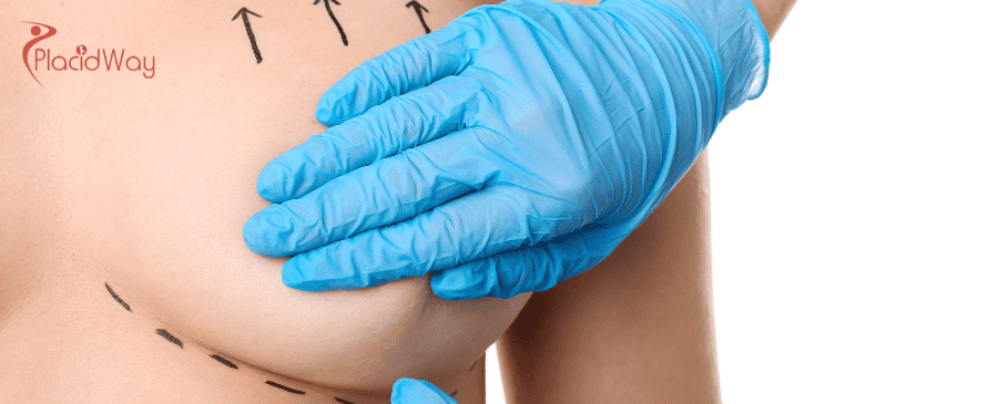 Breast Augmentation in Colombia
