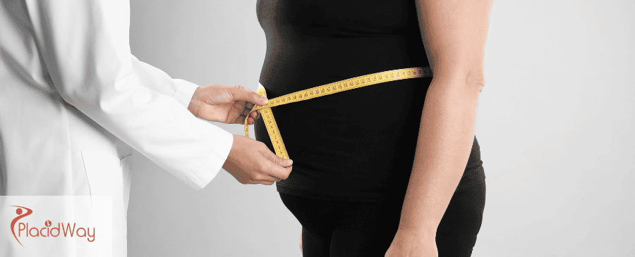 Revision Bariatric Surgery in Mexico