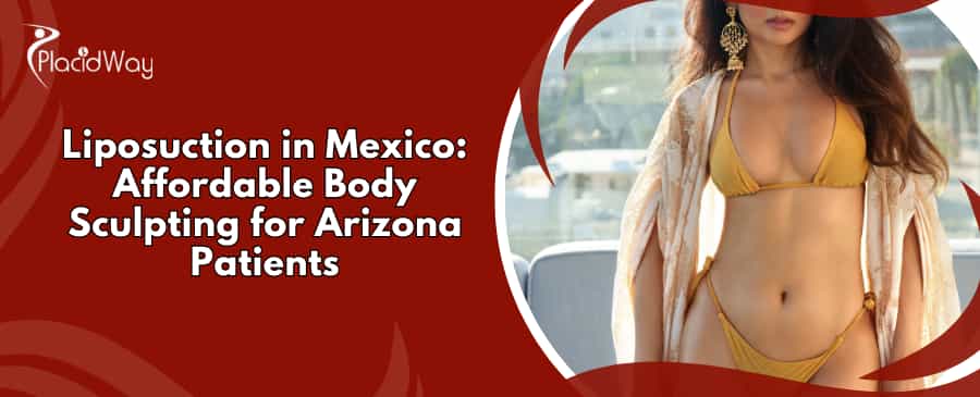 Liposuction in Mexico