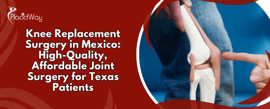 knee replacement surgery in Mexico