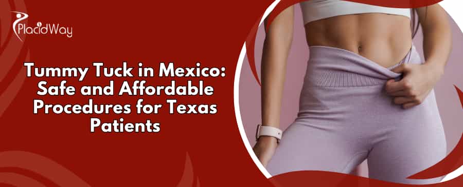 Tummy Tuck Surgery in Mexico