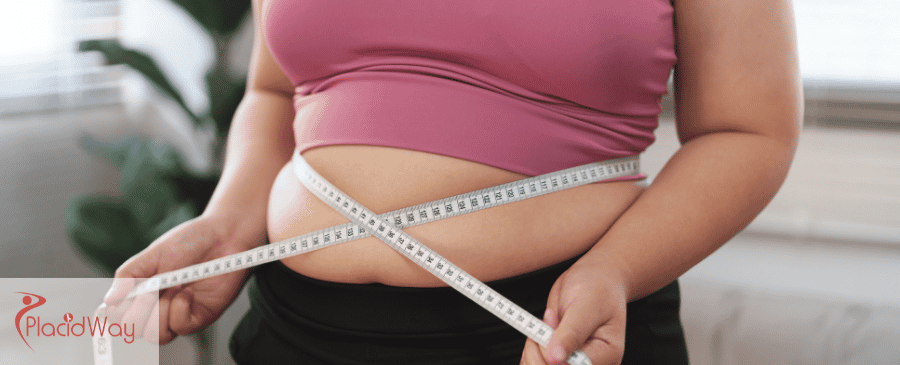 Tummy Tuck Surgery in Mexico