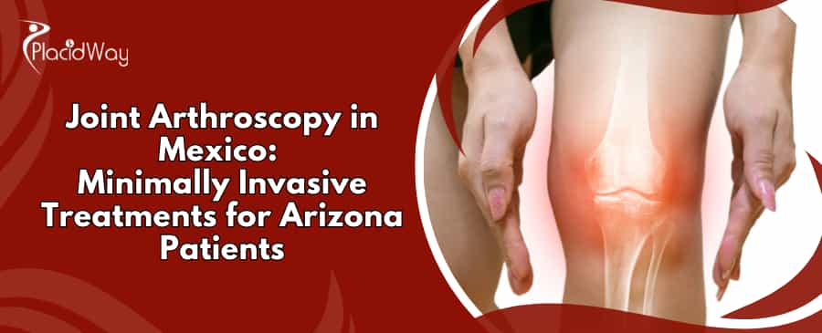Joint Arthroscopy in Mexico
