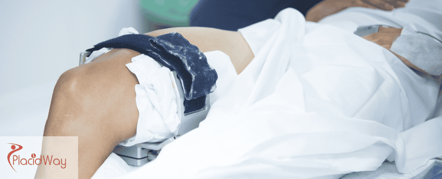 Joint Arthroscopy in Mexico