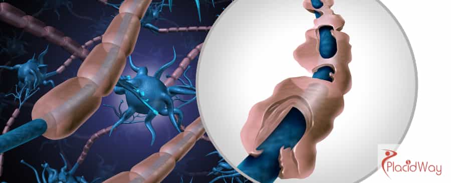 Stem Cell Therapy in Mexico