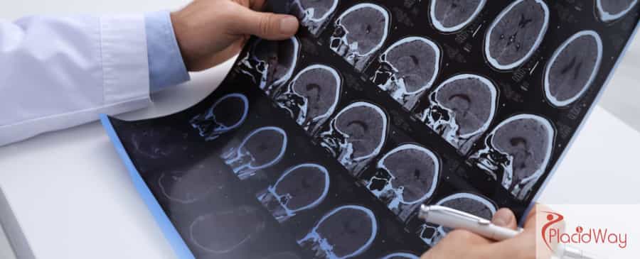 Stem Cell Therapy in Mexico