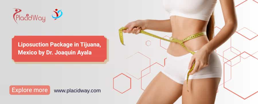 Liposucción Tijuana - Paquete de $3,900 por el Dr. Joaquín Ayala