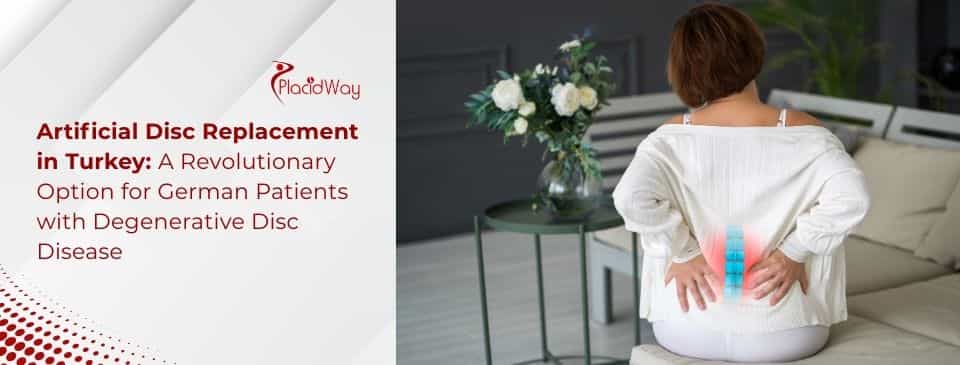 Künstlicher Bandscheibenersatz in der Türkei