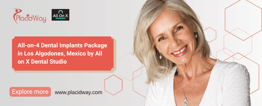 Implantes Dentales All-on-4 Los Algodones, México: Solución Integral para Sonrisas de All on X