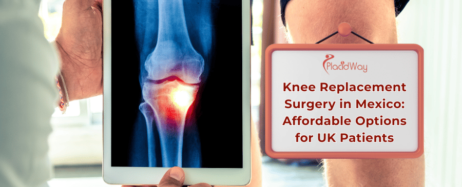 Knee Replacement in Mexico 