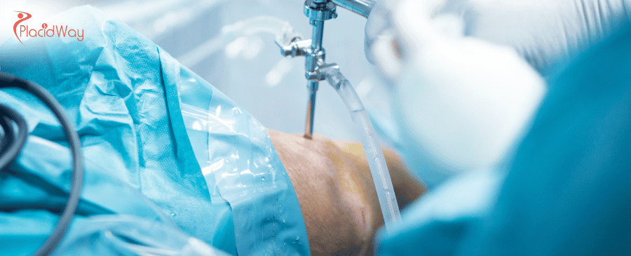 Knee Replacement in Mexico 