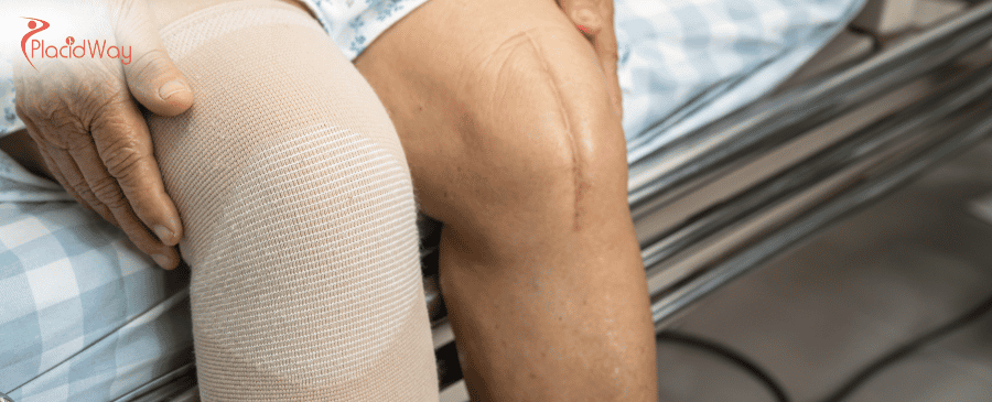 Knee Replacement in Mexico 