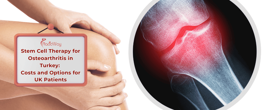 Stem Cell Therapy for Osteoarthritis in Turkey
