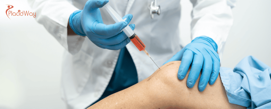 Stem Cell Therapy for Osteoarthritis in Turkey