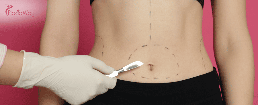 Bariatric Surgery in Thailand