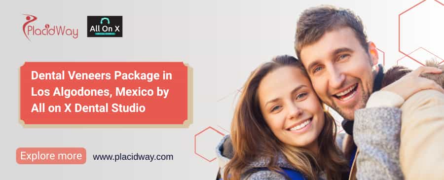 Dental Veneers Los Algodones MX | All on X Dental Studio