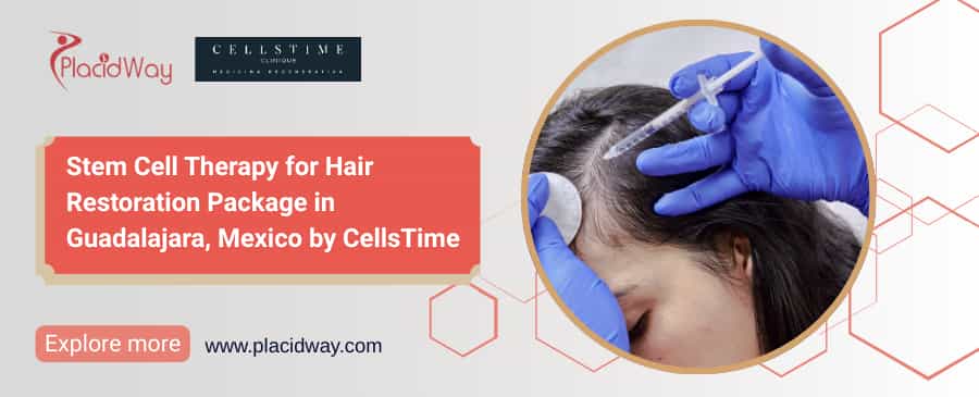 Stem Cell Hair Restoration Mexico | CellsTime