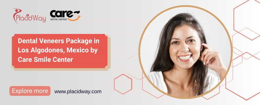 Veneers in Mexico | Care Smile Center