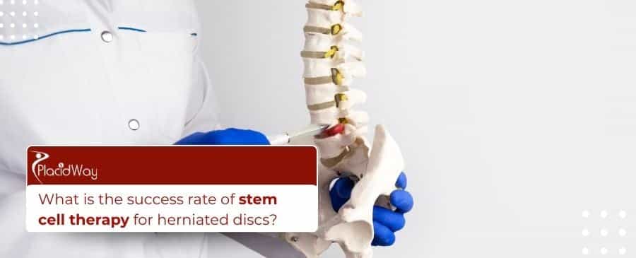 Stem cell therapy for herniated discs