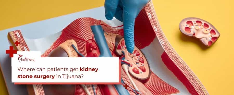 Kidney stone surgery