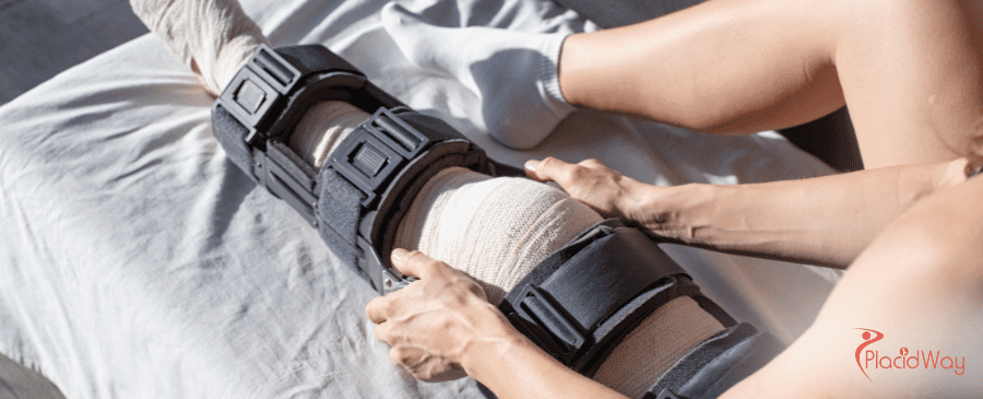 ACL Reconstruction Surgery in Turkey