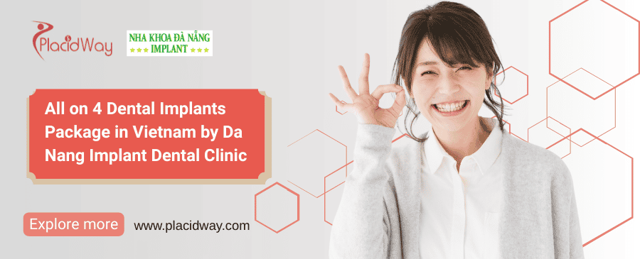 All on 4 Dental Implants Vietnam | Da Nang Implant Clinic