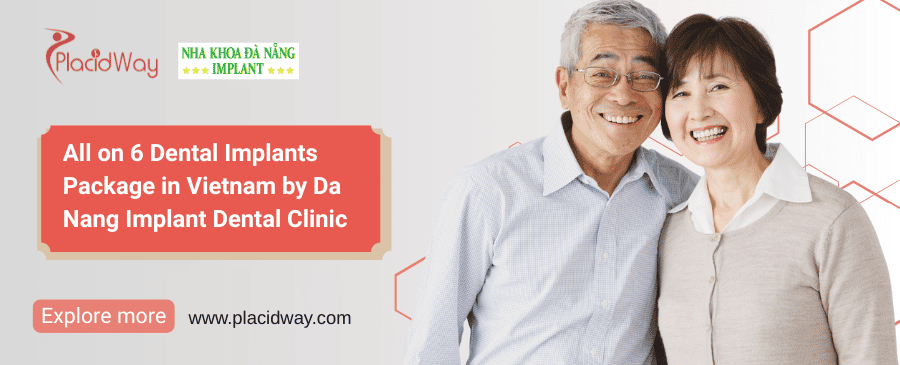 All on 6 Dental Implants Vietnam | Da Nang Implant Clinic