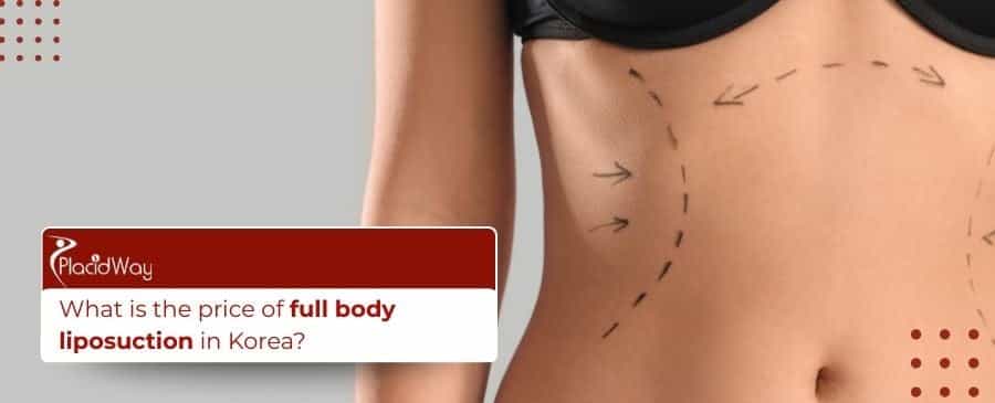 Full body liposuction
