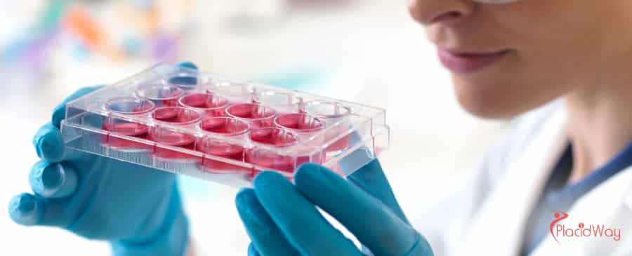 Stem Cell Therapy for Diabetes in Mexico
