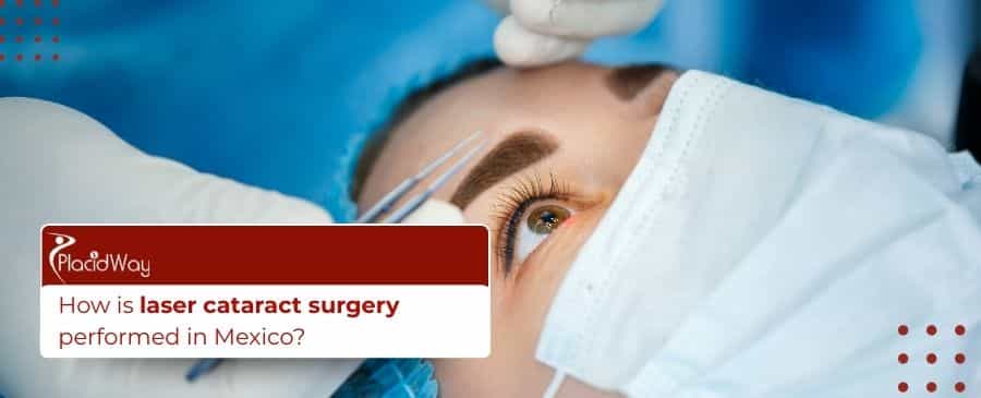Laser cataract surgery