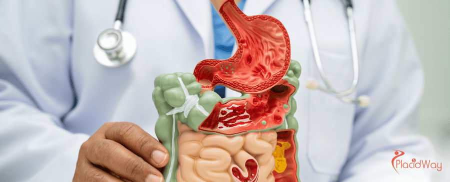 Affordable Sleeve Gastrectomy in Colombia