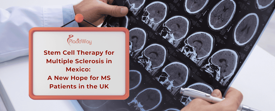 Stem Cell Therapy for MS in Mexico