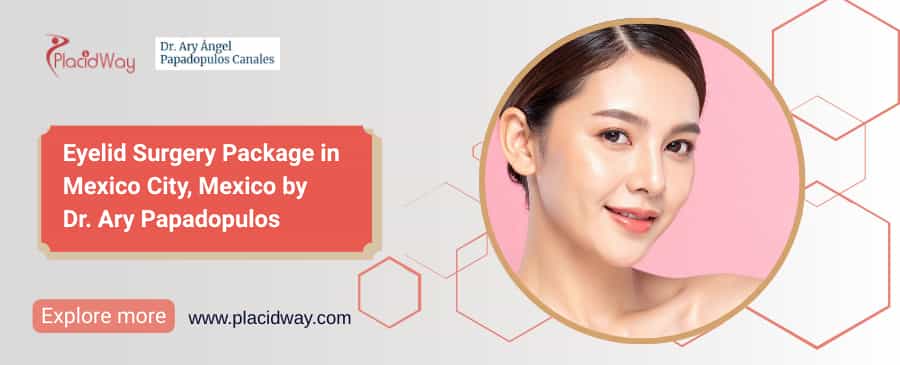 Eyelid Surgery Package | Eyelid Surgery in Mexico by Dr. Ary