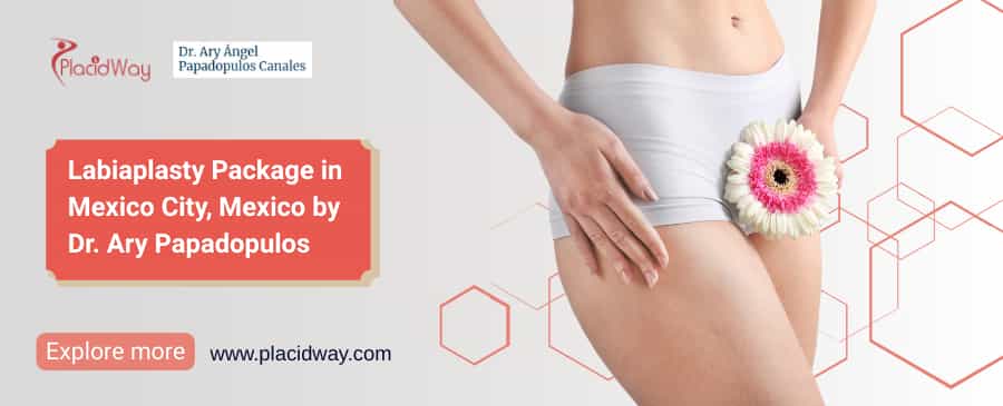 Labiaplasty Package | Labiaplasty Mexico by Dr. Papadopulos