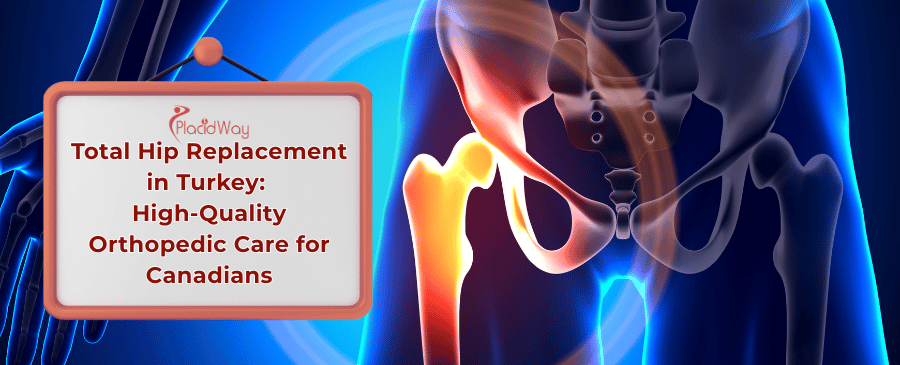 Total Hip Replacement in Turkey
