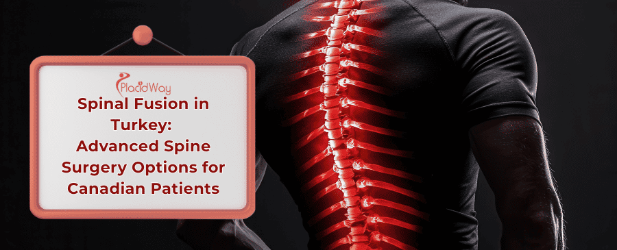 Spinal Fusion Surgery in Turkey