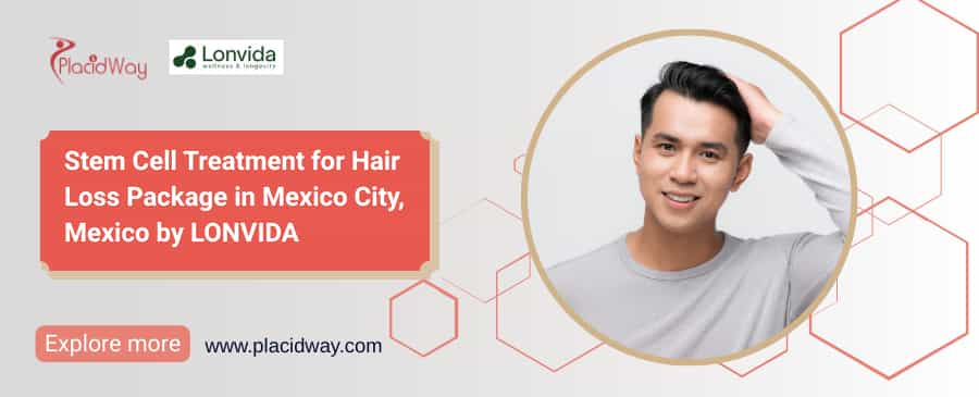 Stem Cell Treatment for Hair Loss Mexico at Lonvida