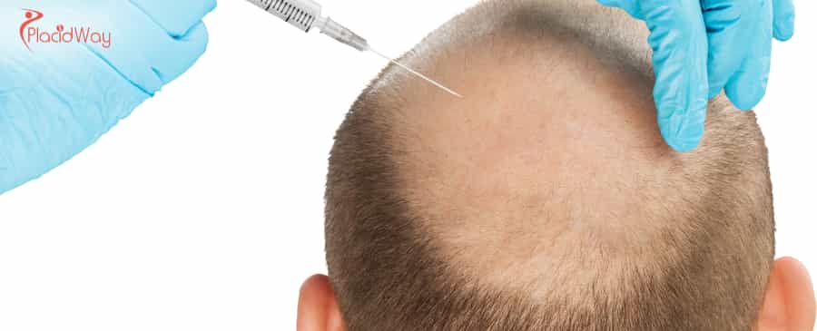 Hair Transplant in Turkey