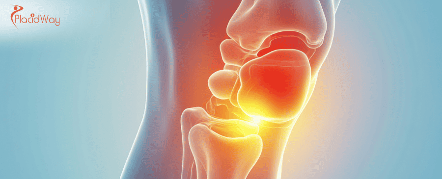 ACL Reconstruction in Turkey