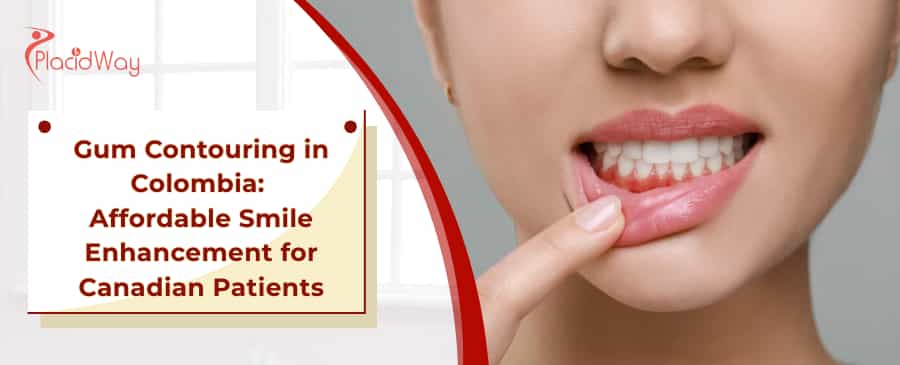 Gum Contouring in Colombia