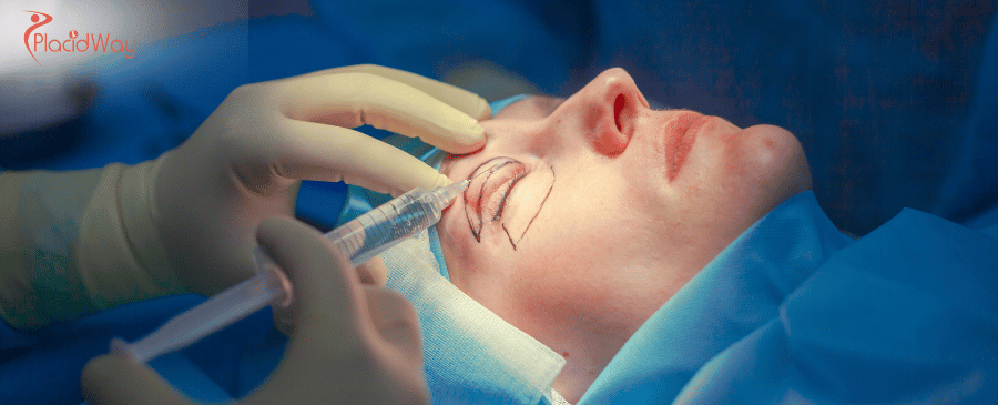 Kostengünstige Augenlidoperationen in Thailand