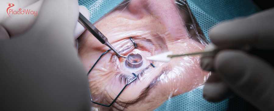 Affordable Cornea Transplant in Thailand