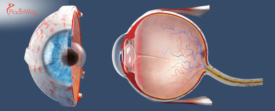 Affordable Cornea Transplant in Thailand