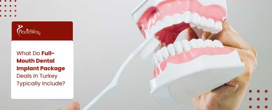 Implante dental de boca completa